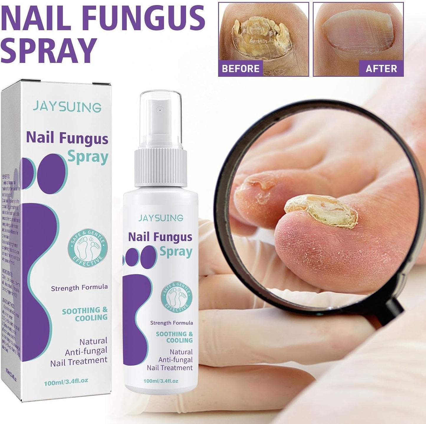 FUNGAL NAIL TREATMENT FOR TOENAILS EXTRA STRONG,100ML SPRAY FOR NAILS