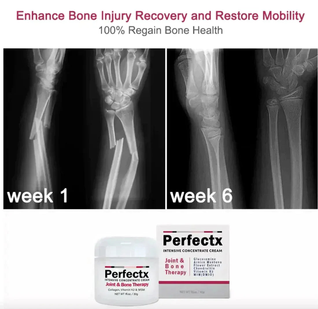 PERFECTX JOINT AND BONE THERAPY BALM